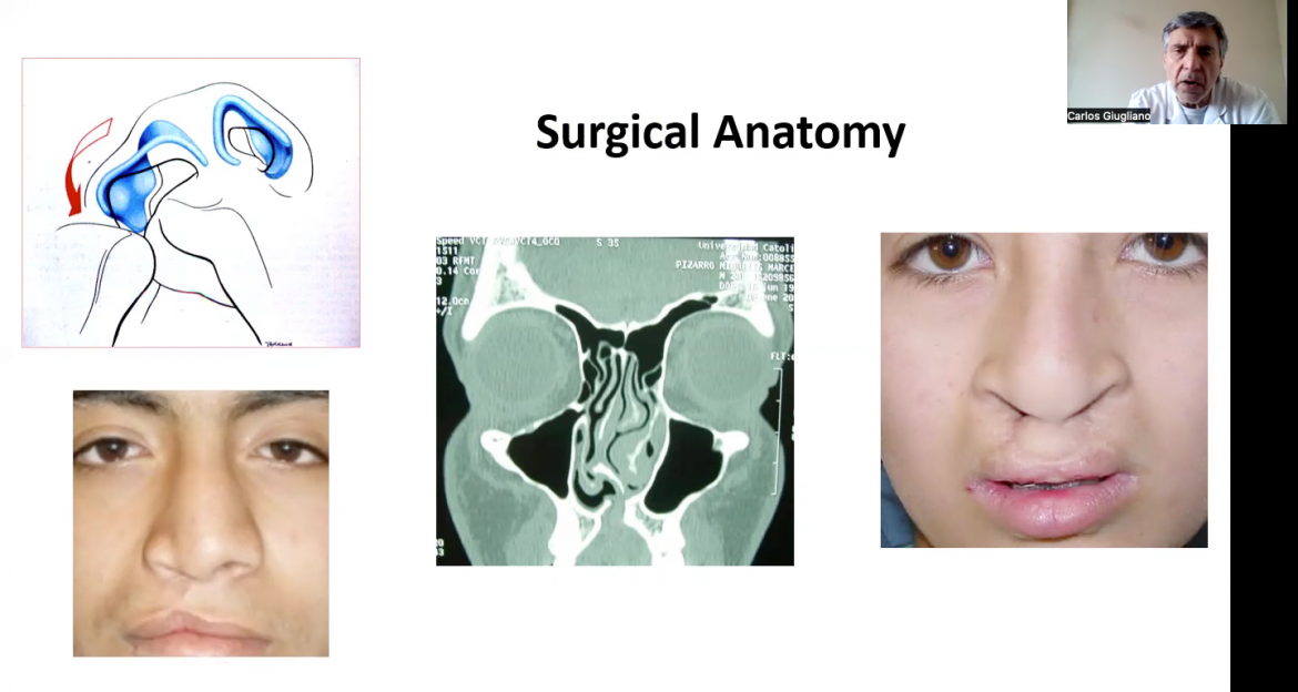 Presentación Dr. Carlos Giugliano - 5th International Comprehensive Cleft Care Workshop (CCCW)